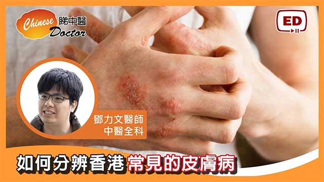 鄧力文中醫師-如何分辨香港常見的皮膚病